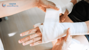 A nurse carefully wraps a bandage around a patient’s hand after excisional debridement to promote healing and prevent infection.
