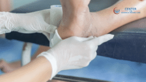 Doctor treating a foot ulcer using modern medical tools in a US clinic