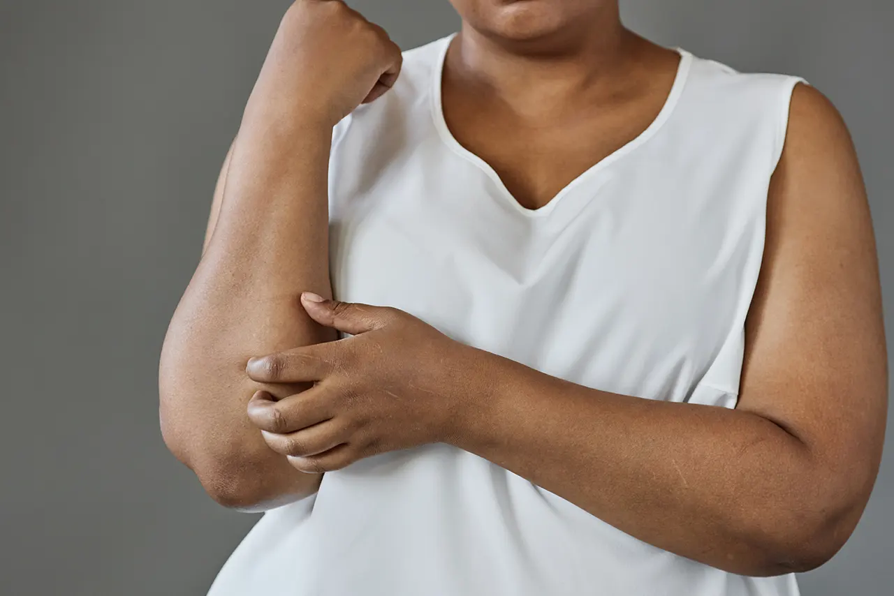 Evaluation for lower extremity lymphedema