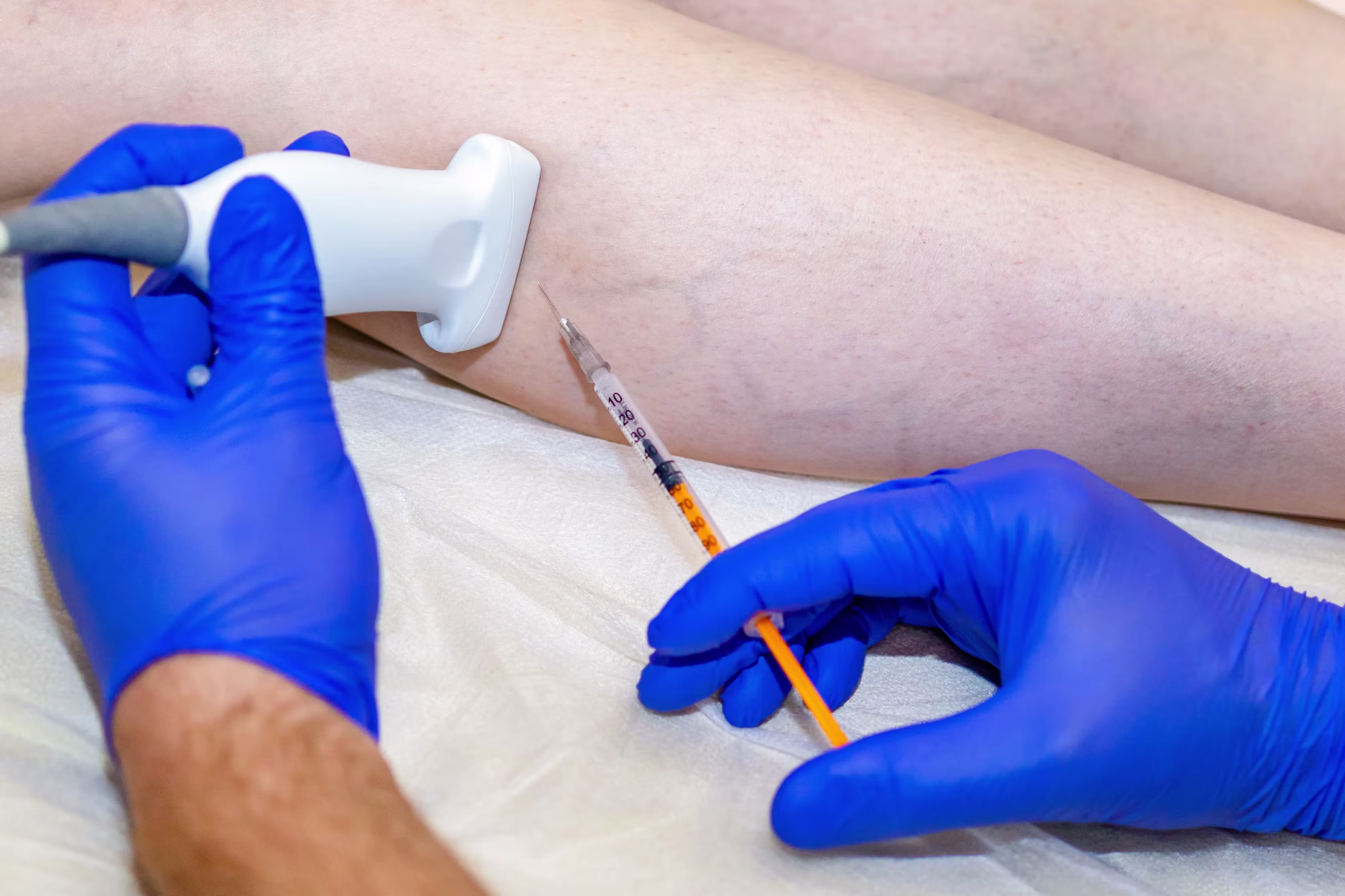 Vascular ultrasound and diagnostic testing