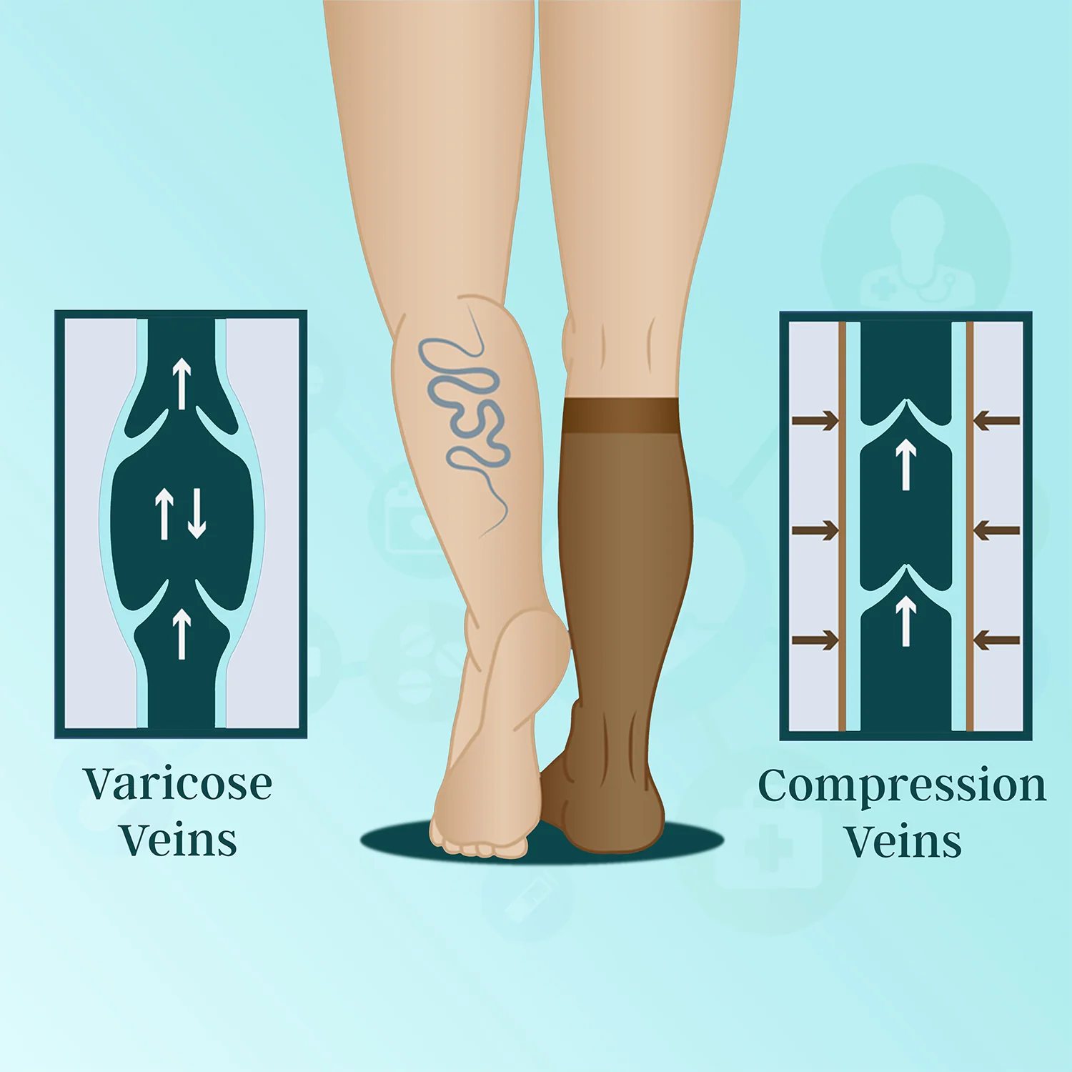 Compression therapy for venous circulation