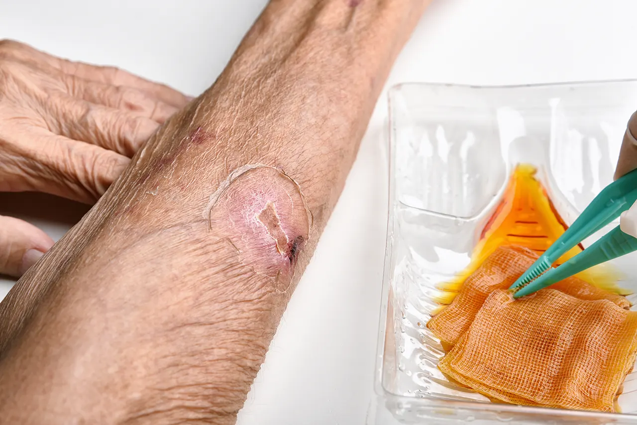 Evaluation of a non-healing wound