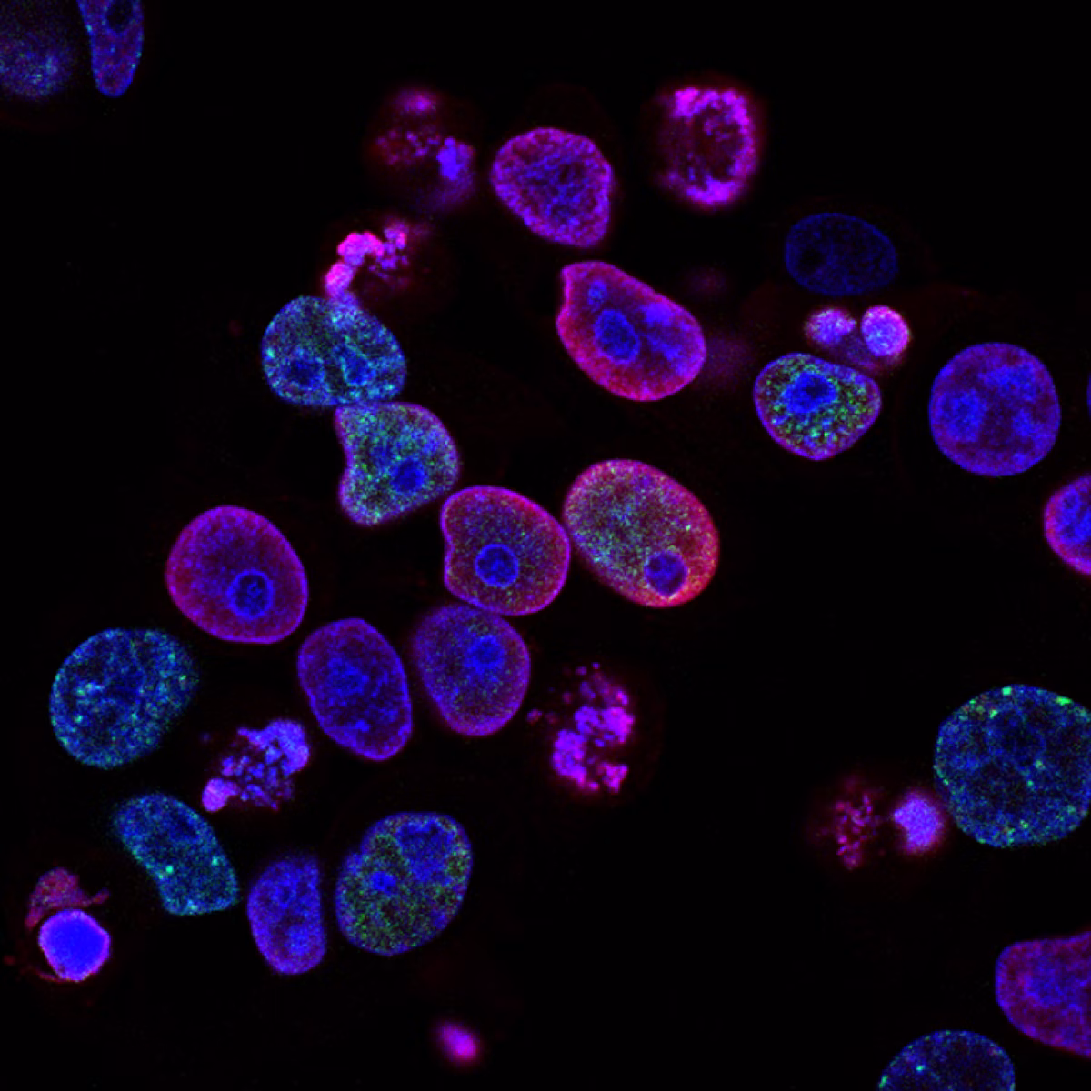 Cancer research team working in a laboratory