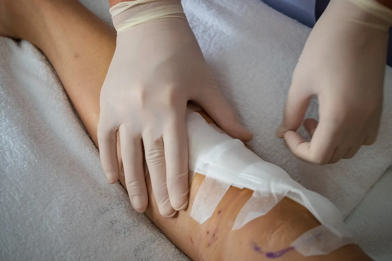 Evaluation and care of a post-surgical wound
