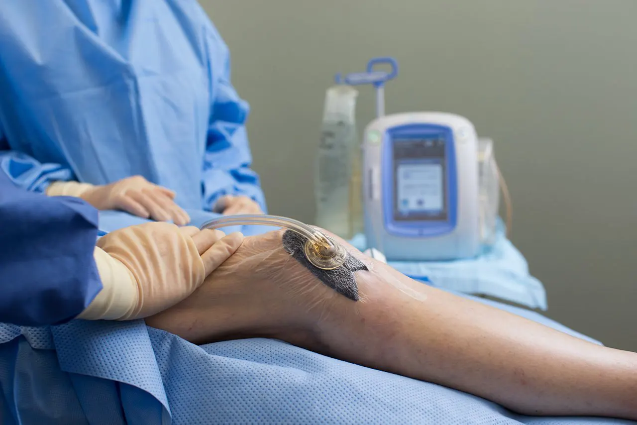 VAC negative pressure dressing on a patient's lower leg