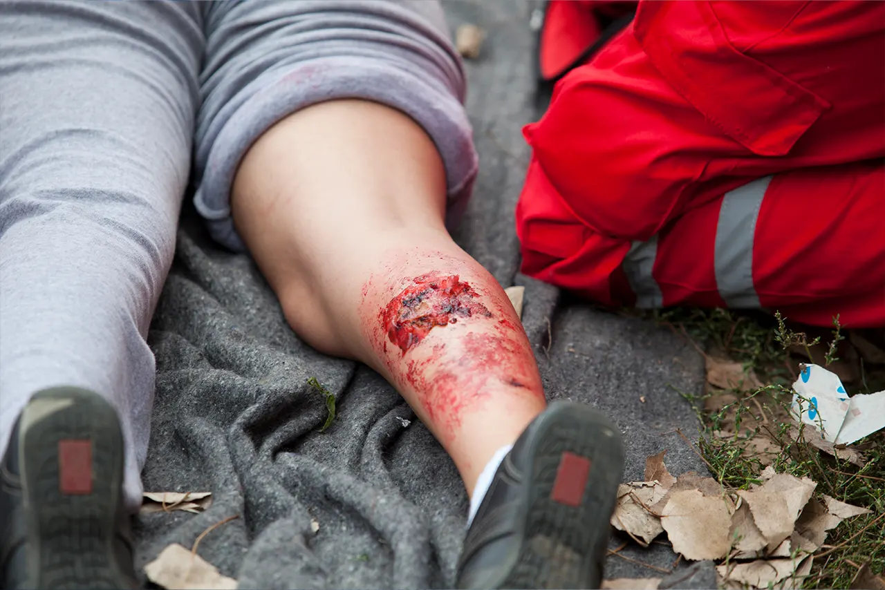Evaluation and treatment of a traumatic wound