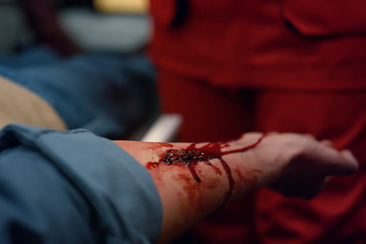 Specialized treatment of a traumatic wound