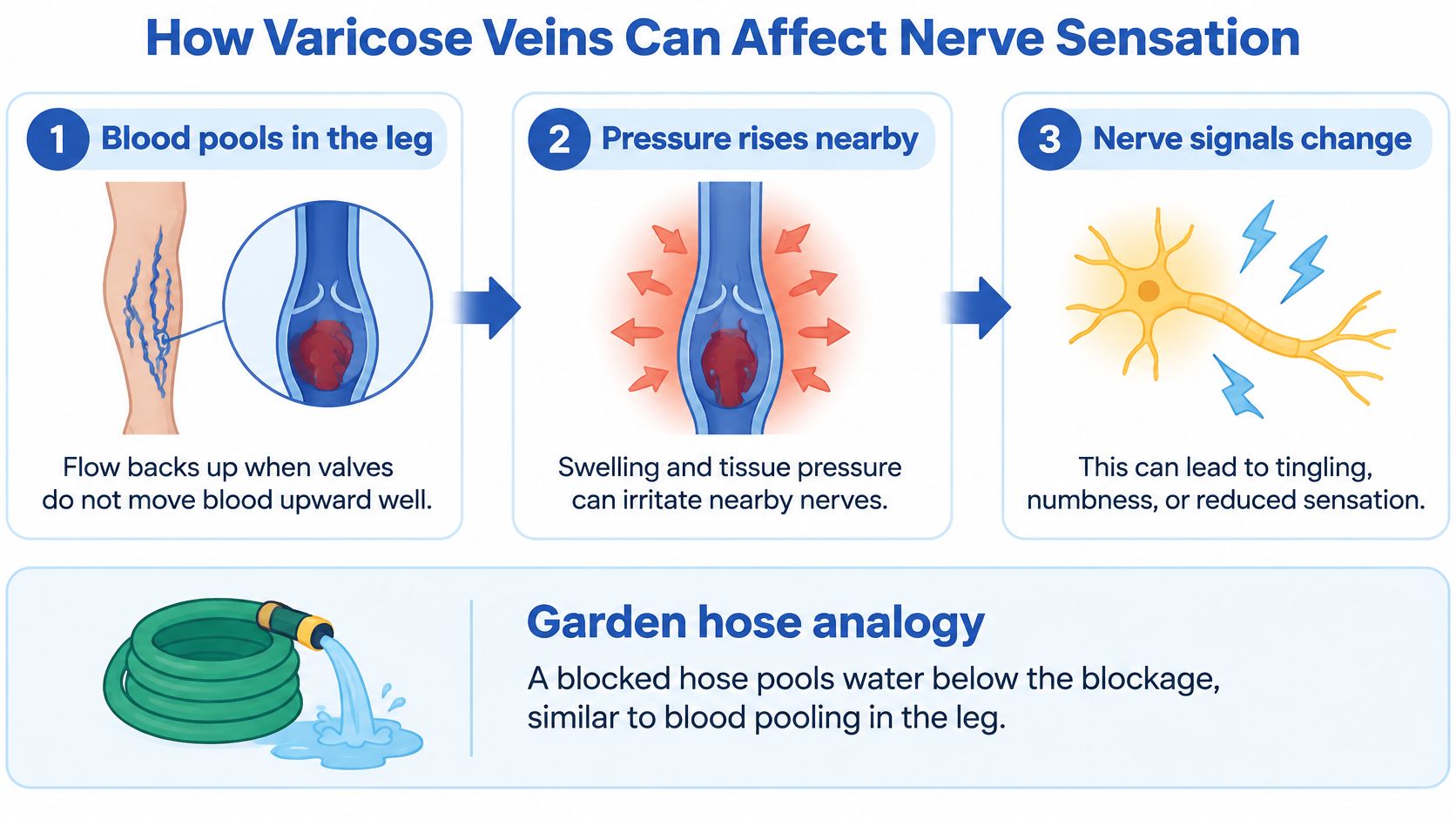 A diagram explaining how varicose veins can cause nerve sensations like numbness, tingling, and reduced sensitivity.