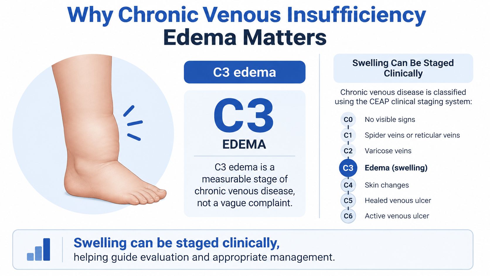 An infographic explaining the CEAP clinical staging system for chronic venous insufficiency, highlighting C3 edema and swelling.