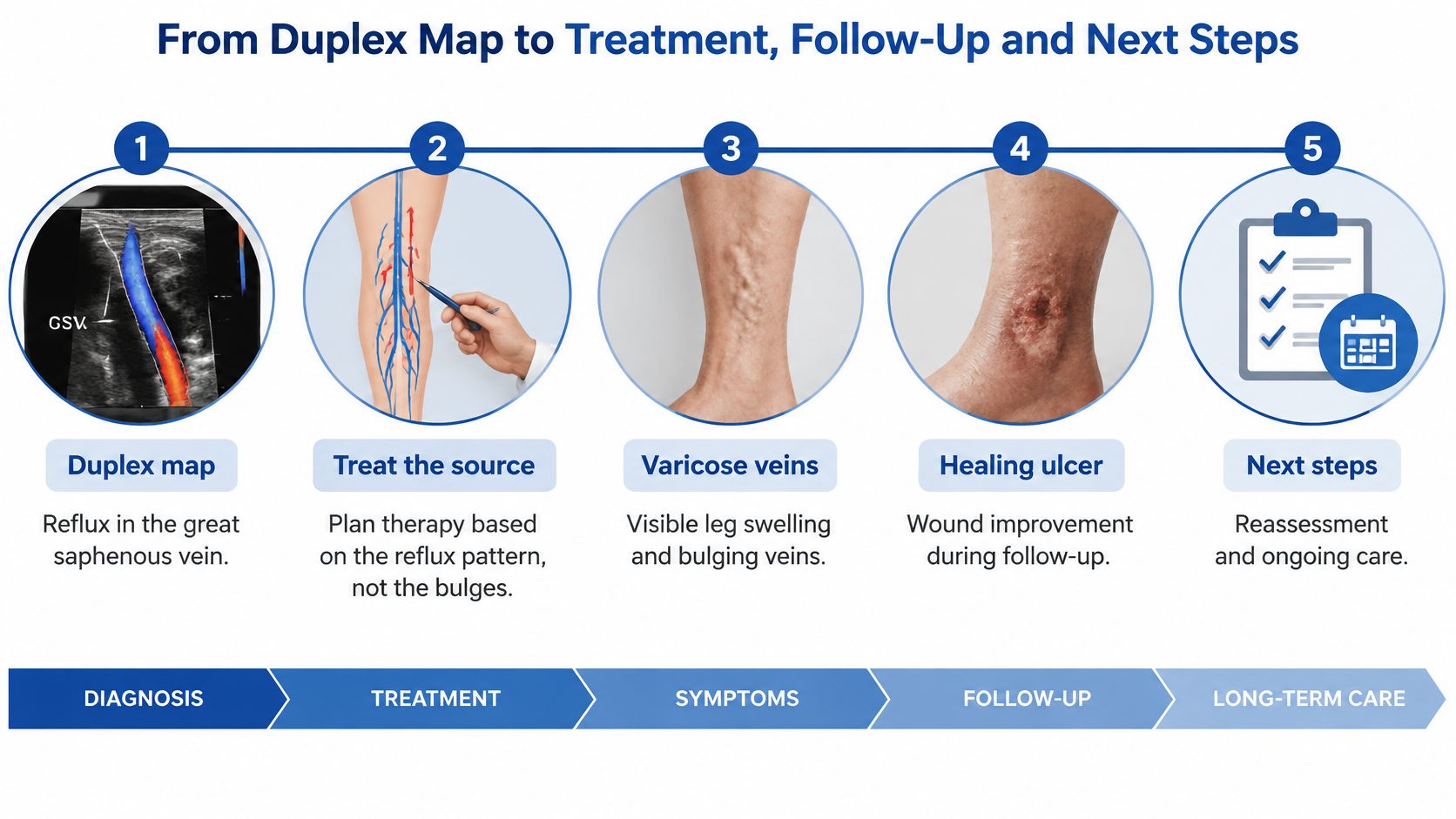 A five-step medical infographic showing the process from duplex ultrasound diagnosis to varicose vein treatment and follow-up care.