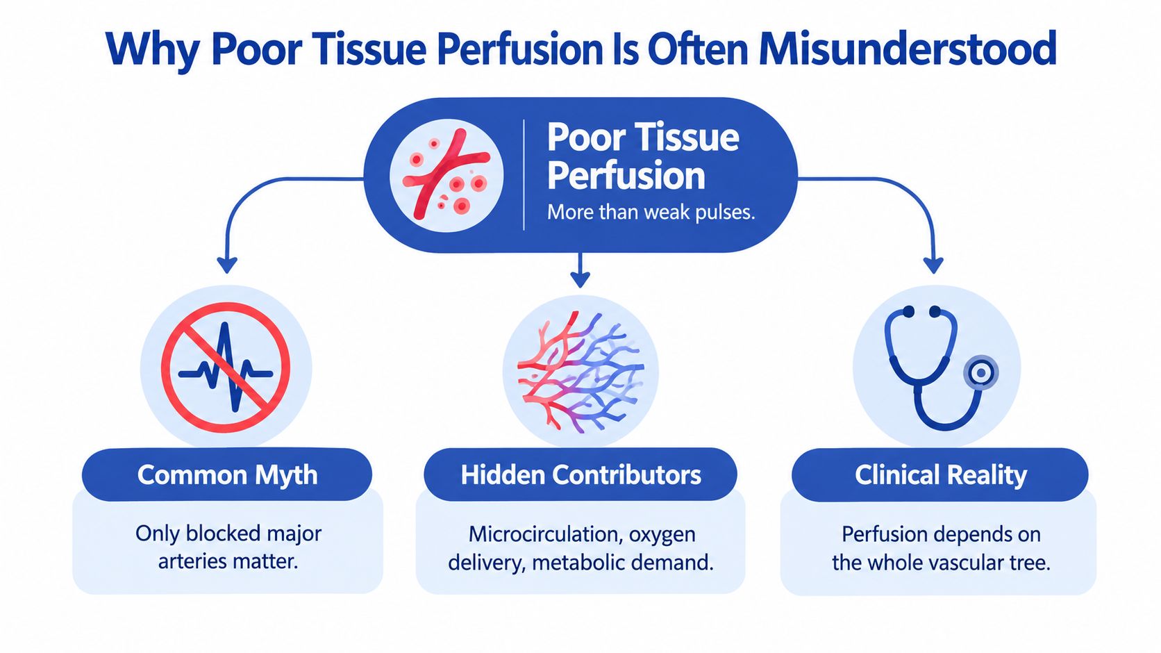 An infographic explaining that poor tissue perfusion involves more than just weak pulses or blocked major arteries.