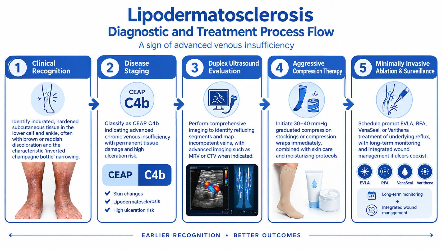 A diagnostic and treatment process flow chart for lipodermatosclerosis illustrating five key steps for venous insufficiency management.