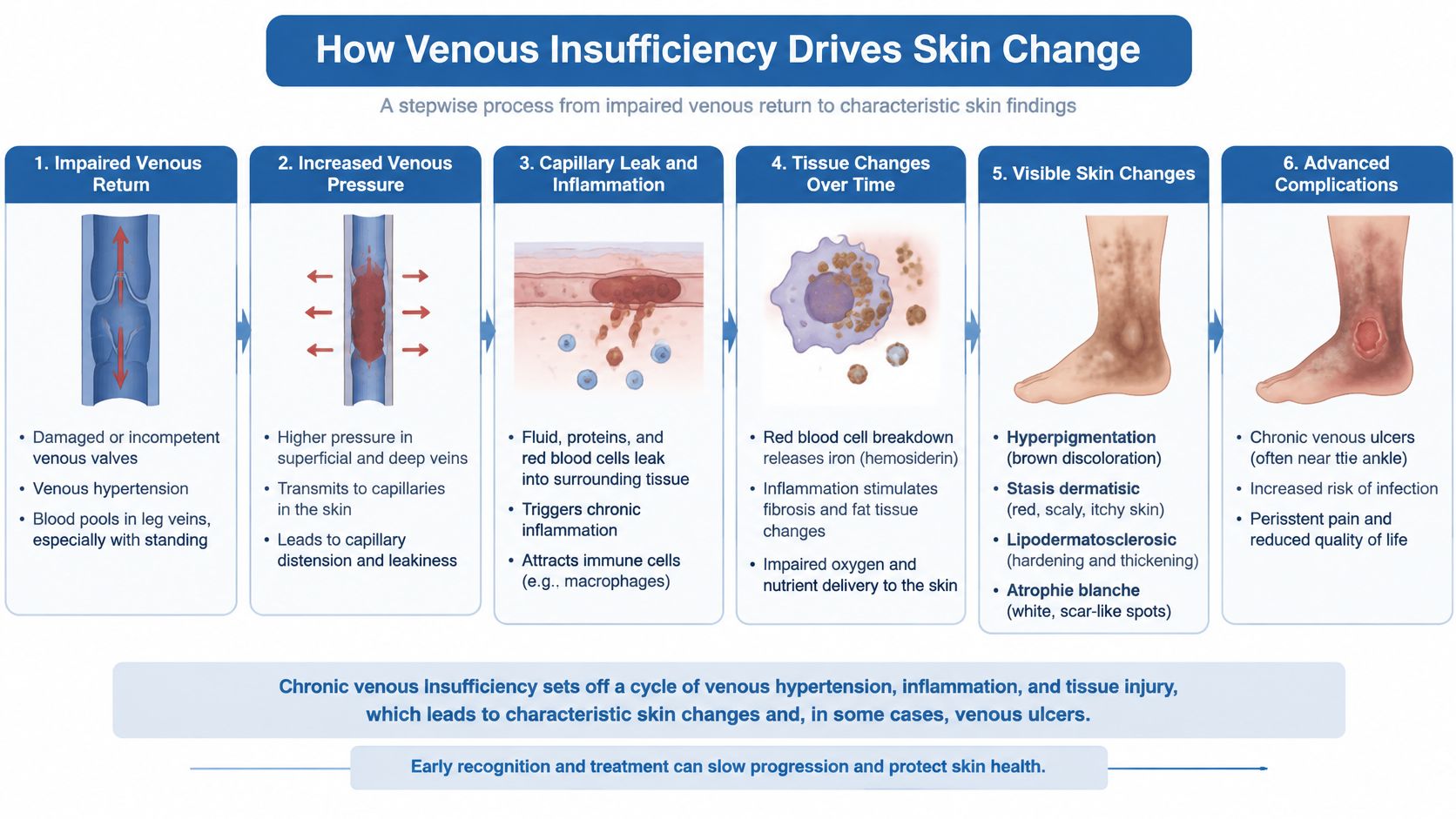 A step-by-step infographic explaining how chronic venous insufficiency leads to skin changes and venous ulcers.